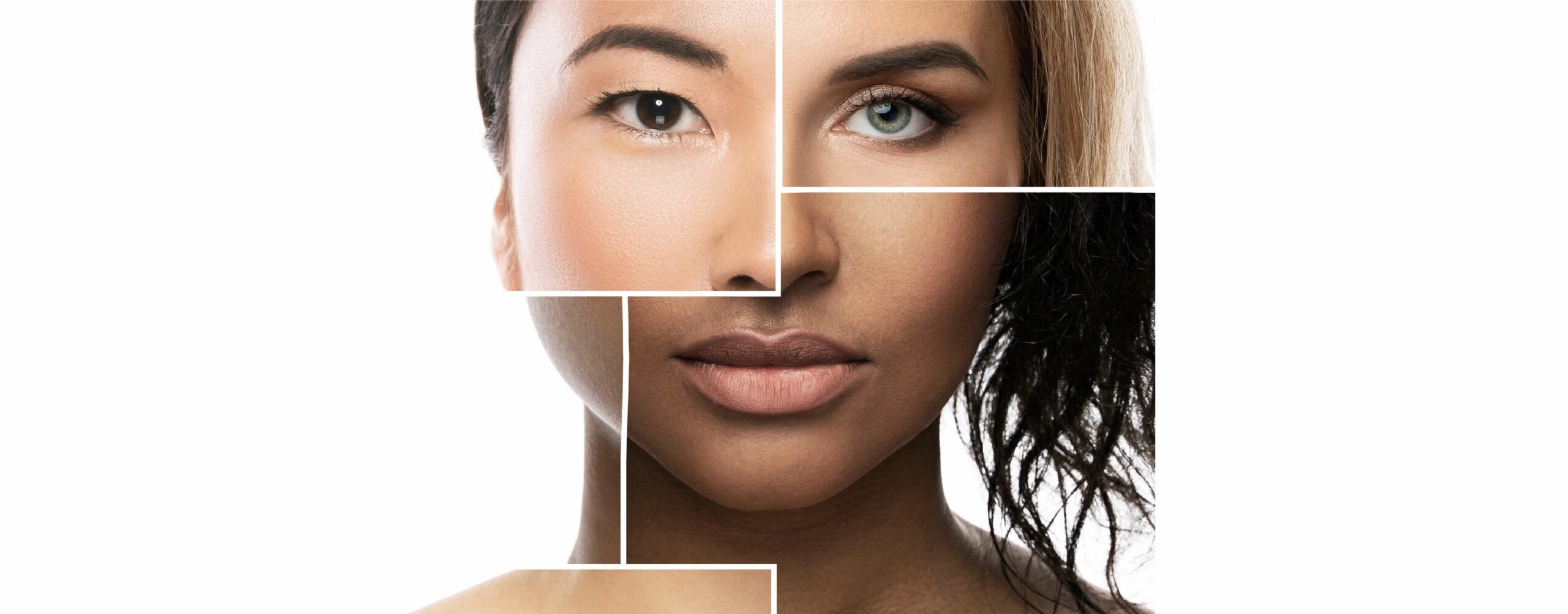 pigmentation a top concern for south african skins